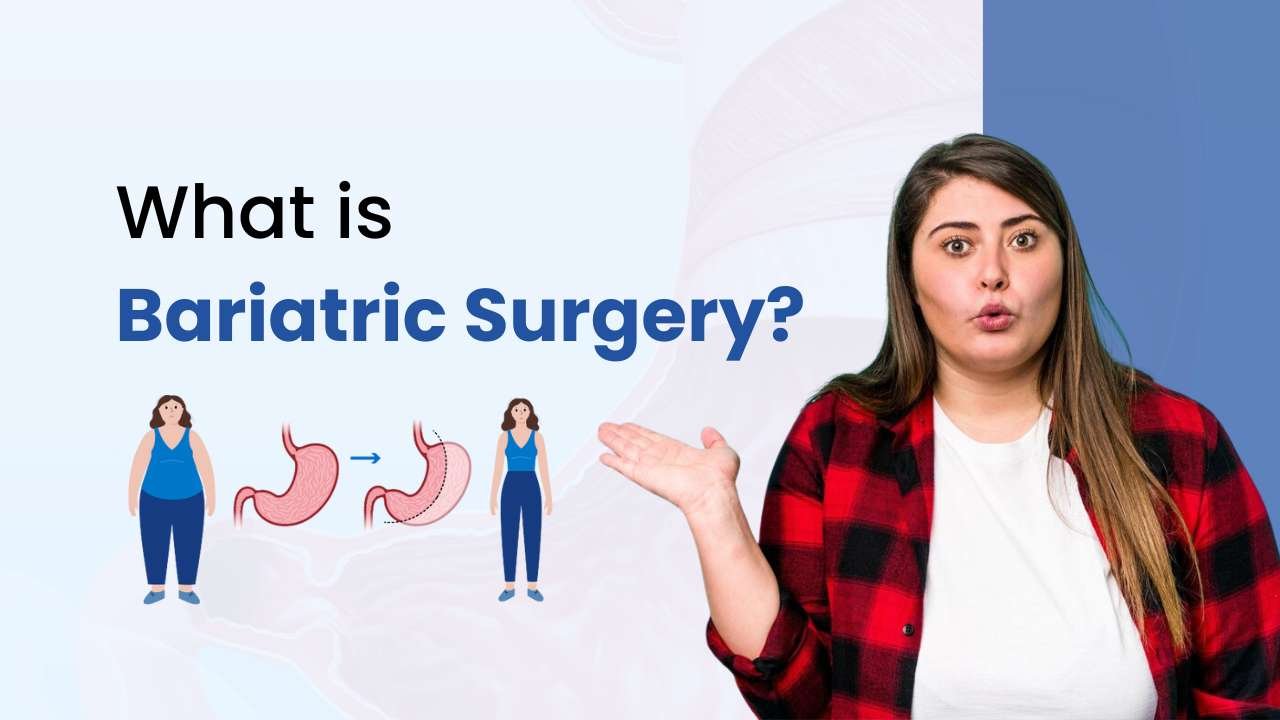 what is bariatric surgery 